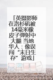 英摄影师在洛杉矶被14毫米橡皮子弹射中大腿 当地华人：像误闯“末日生存”游戏